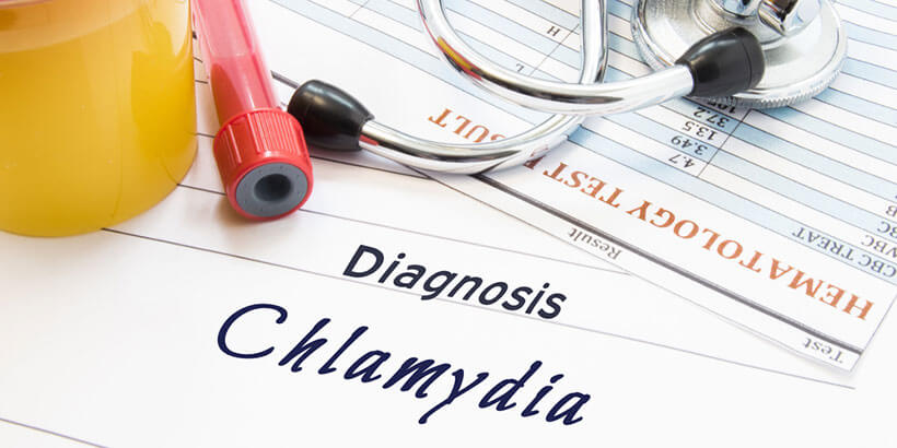 Chlamydia Test Overview