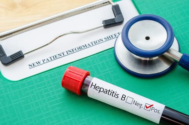 Hepatitis Blood test Walk In Lab
