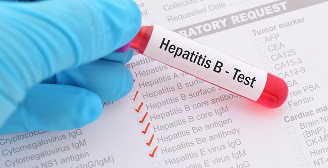 Personalabs Hepatitis B