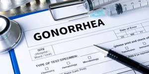 gonorrhea testing