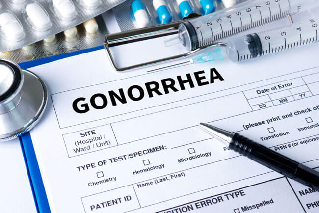gonorrhea testing