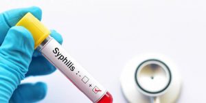 Everything You Need To Know About Syphilis Testing