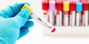 Everything You Need To Know About HIV Testing