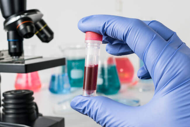 Everything You Need To Know About Hepatitis A Testing