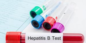 Everything You Need To Know About Hepatitis B Testing