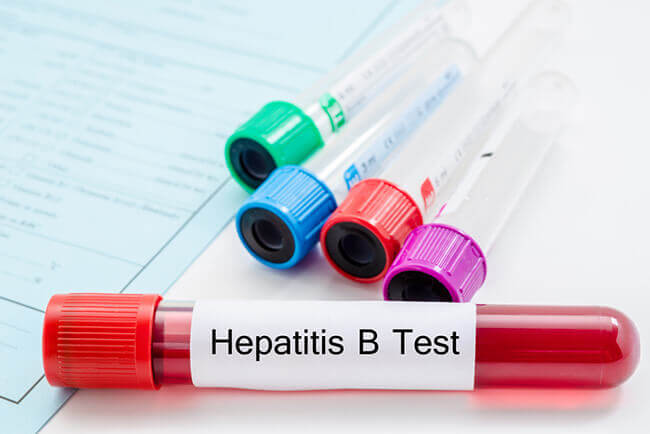 Everything You Need To Know About Hepatitis B Testing