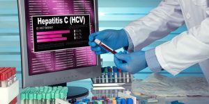 Everything You Need To Know About Hepatitis C Testing