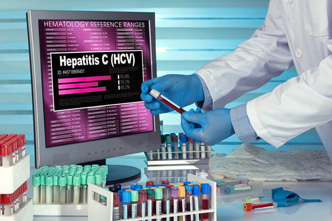 Everything You Need To Know About Hepatitis C Testing