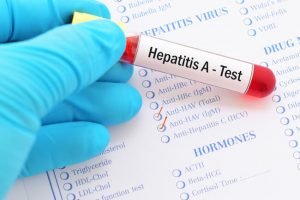 Testing Solutions For Hepatitis A