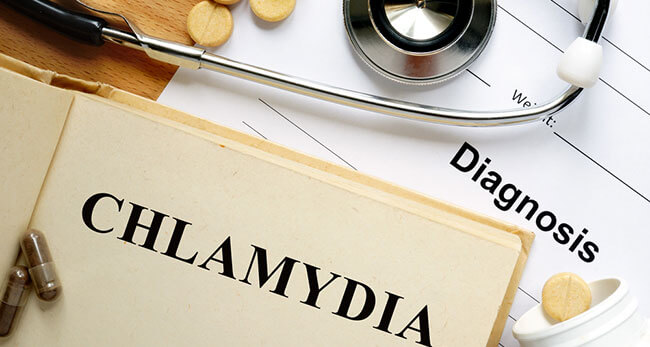 How Is Chlamydia Treated