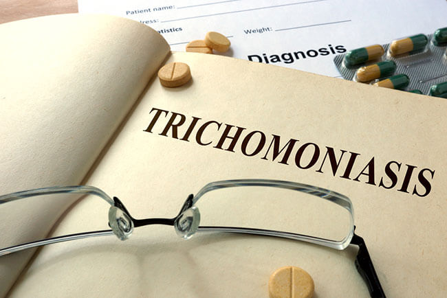 Trichomoniasis In Men