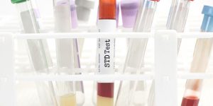 How Accurate Are STD Tests?