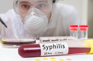 Latent Syphilis Symptoms